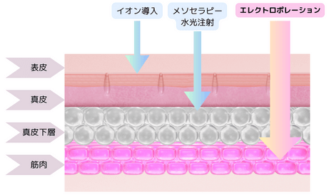 イオン導入の20倍の浸透力！